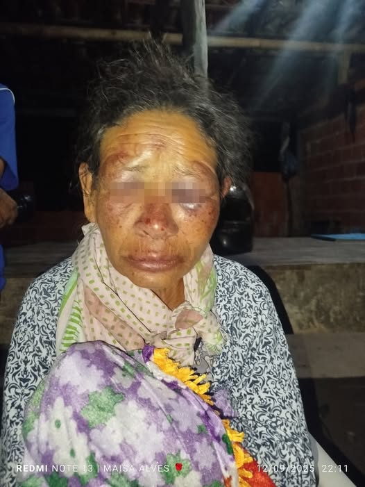 EM CÔNEGO MARINHO/MG, POLÍCIA CIVIL FAZ OPERAÇÃO CONTRA MULHERES ENVOLVIDAS EM ROUBO E ESPANCAMENTO DE IDOSA NA ZONA RURAL