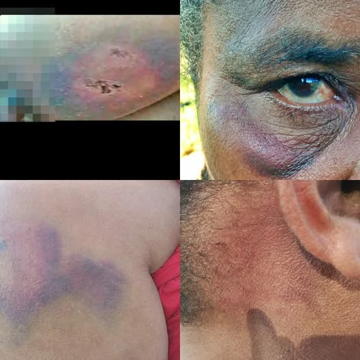 Violência na Aldeia: Homem agride esposa com pedaço de madeira em São João das Missões