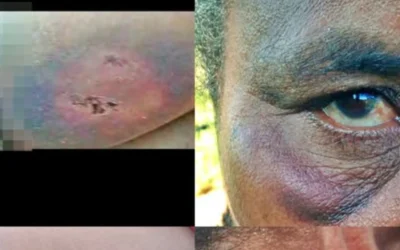 Violência na Aldeia: Homem agride esposa com pedaço de madeira em São João das Missões