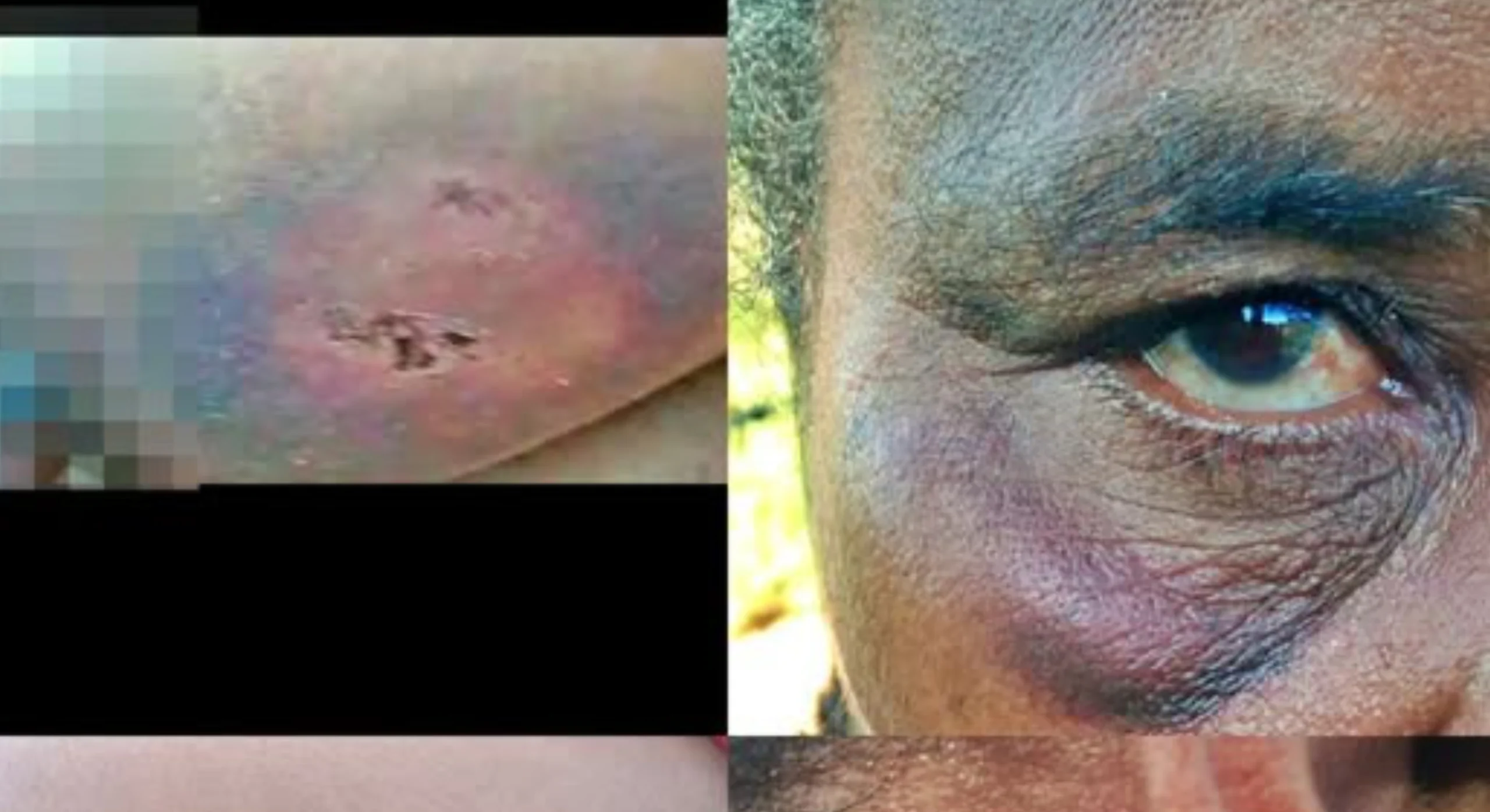 Violência na Aldeia: Homem agride esposa com pedaço de madeira em São João das Missões